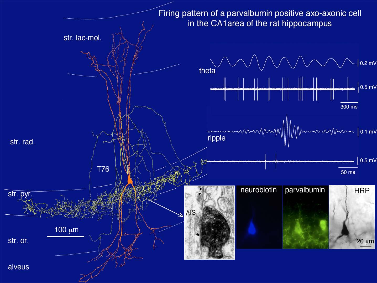 ©MedUni Wien/Zentrum für Hirnforschung
